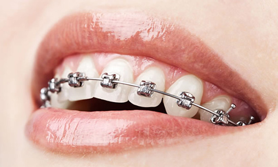ortodonzia dentista massella verona